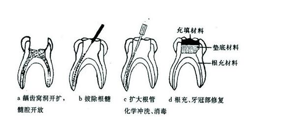 成都義齒產(chǎn)業(yè)在國際市場上的地位如何？? | 成都義齒廠家